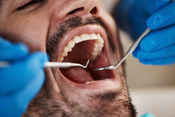 Best Emergency Dental Care for Sports Injuries in Neffs, OH