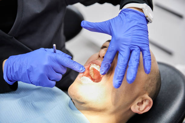 Best Emergency Wisdom Tooth Extraction in Neffs, OH